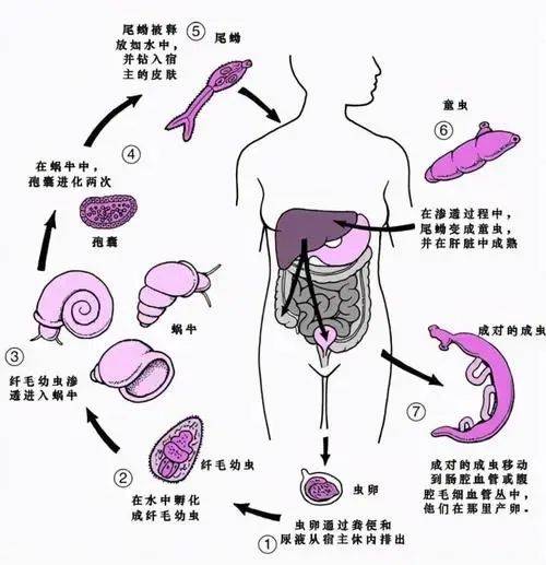 十大寄生虫图片危险图片