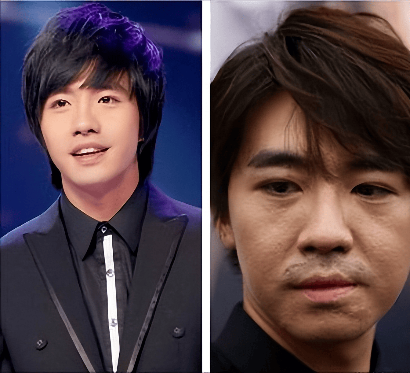 恶毒女配李依晓,被叶璇狗咬毁容,如今面部僵硬遭群嘲!