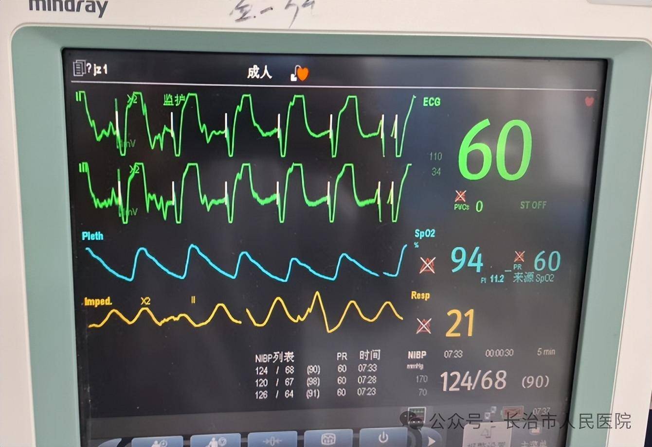 心电监护仪心率怎么看图片