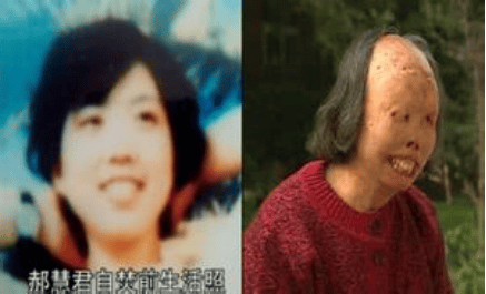郝惠君自焚前后的照片▲陈果自焚前后的照片▲"1·23"集体自焚事件