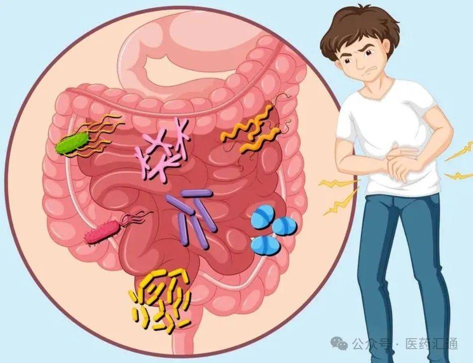 急性肠胃炎的症状图片