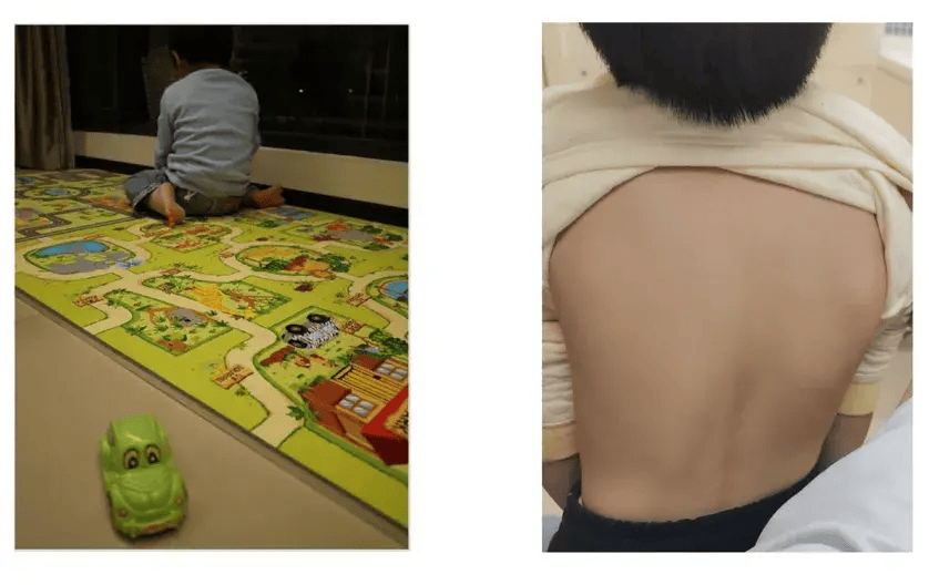 崔玉涛:孩子所有的身心发育问题,要从近中远三个点来看待