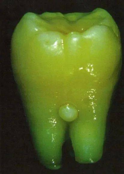 小满时节～来看看这篇牙科科普帖_治疗_牙齿_畸形