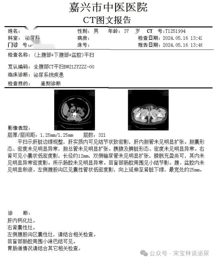 从左肾下极延伸至左阴囊(bl002).急求同行指点!