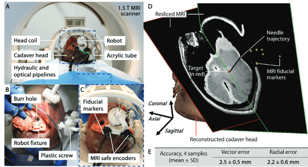 学术动态 | 香港大学研发出磁共振引导下的神外手术机器人 研究成果发表在Advanced Science 误差低于3毫米