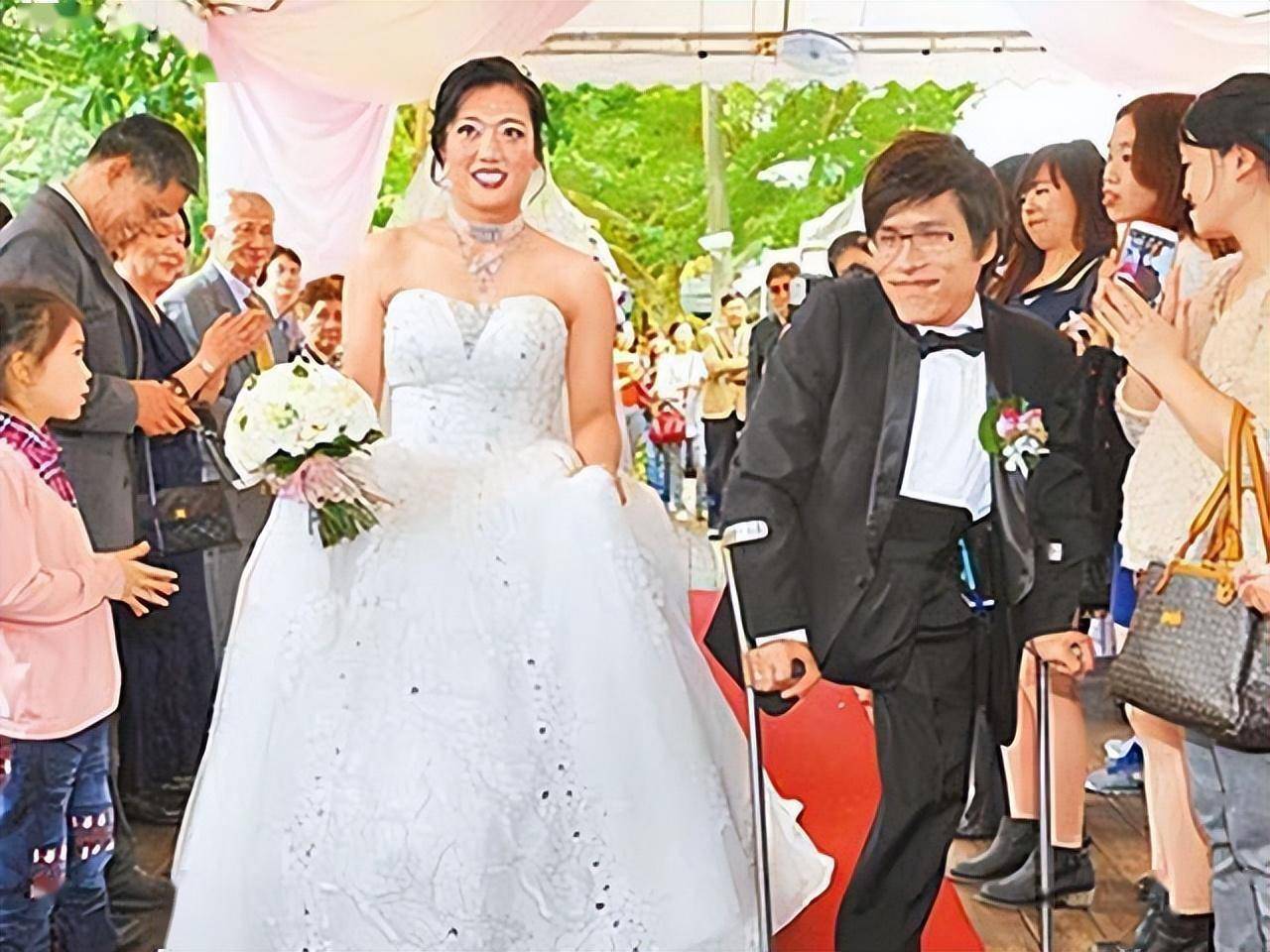 美国90后"连体双胞胎":腰部以下所有器官共享,如今姐姐已结婚