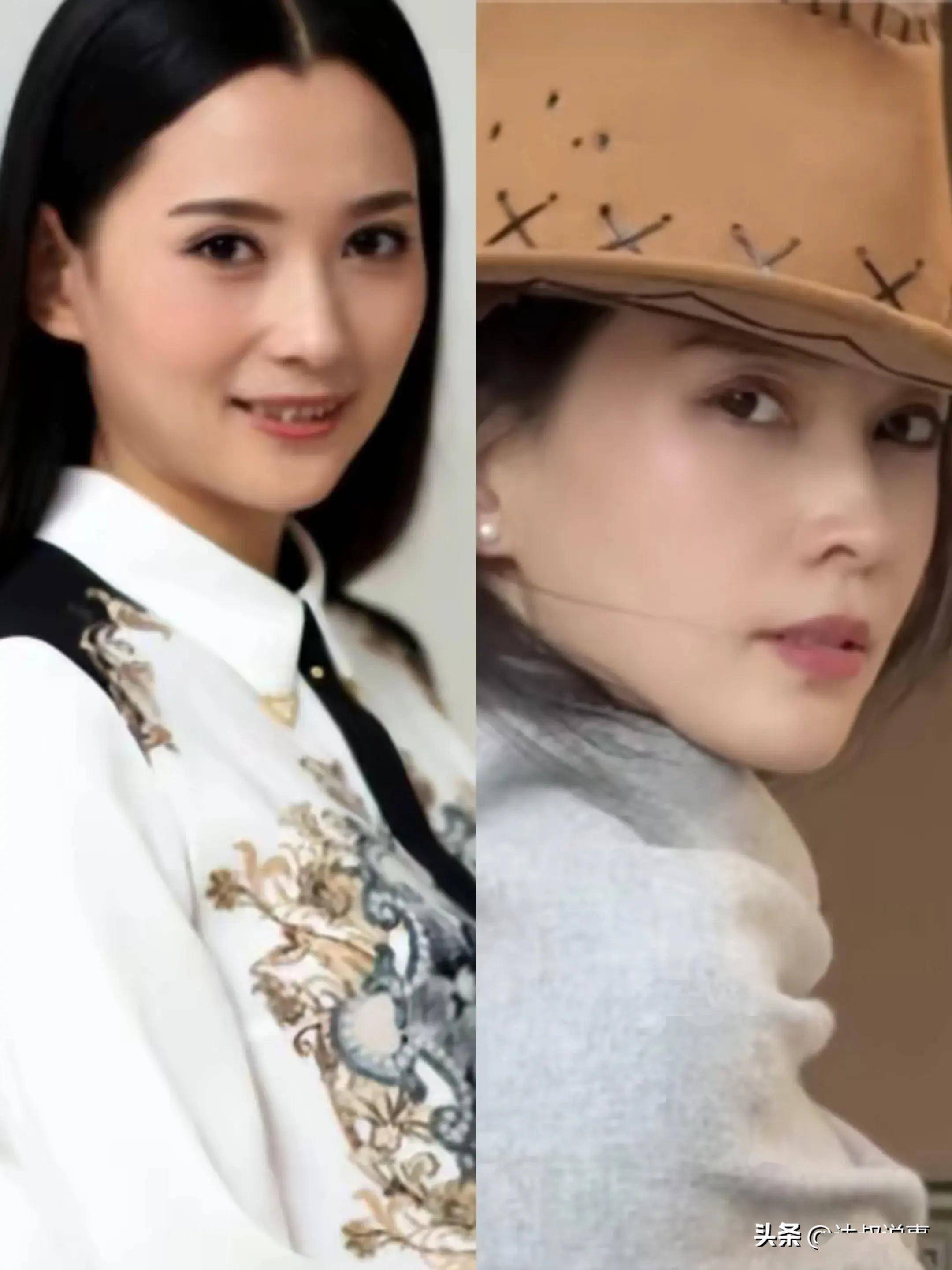 森林北(李巧)到底有没有整容?看她前后的照片对比就知道答案了_气质_因为_牙齿