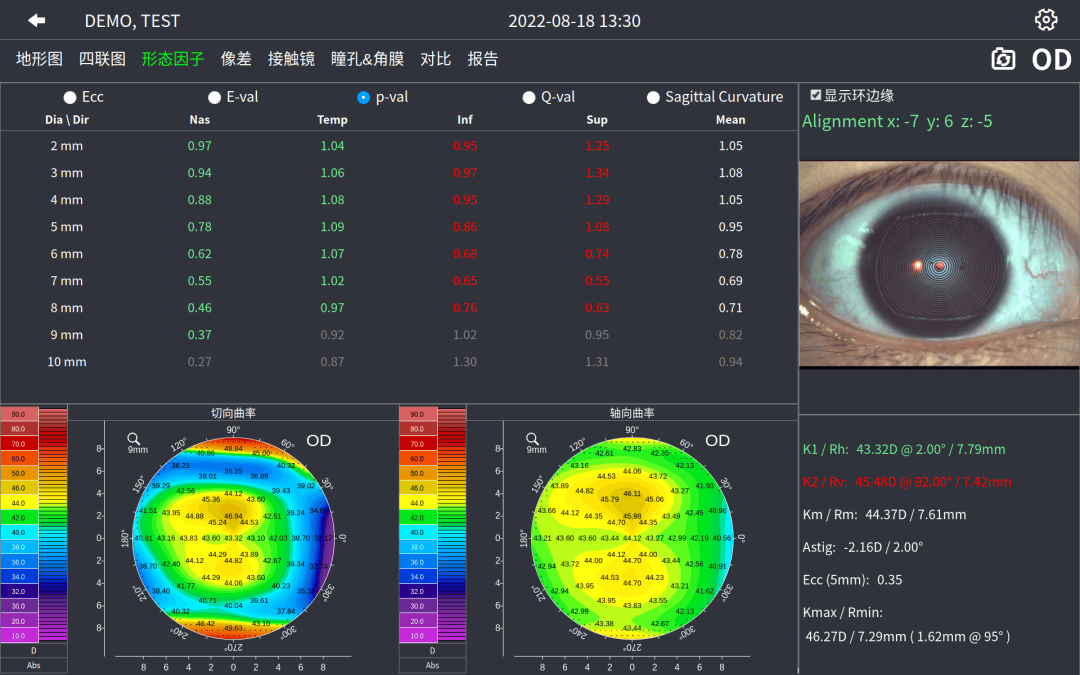 角膜地形图的解读