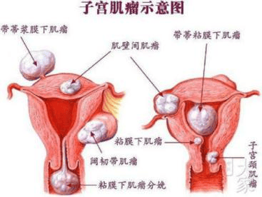 健康的宫颈真实照片图片