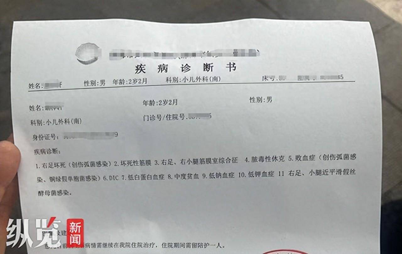 有再次截肢风险_谌先生_治疗_手术