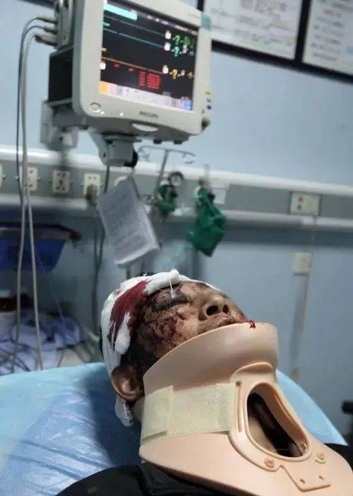 吊运钢卷卡具滑脱,某制桶厂操作工头被压扁!