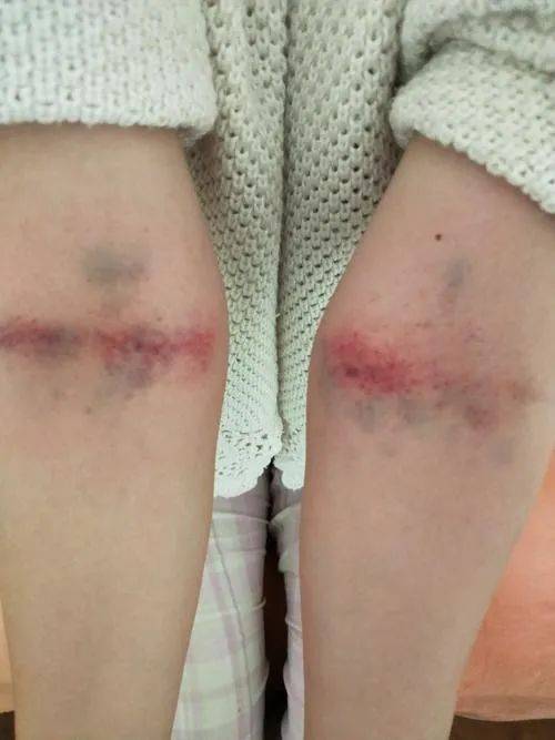 这四个地方通了,心肝脾肺肾就都好了!