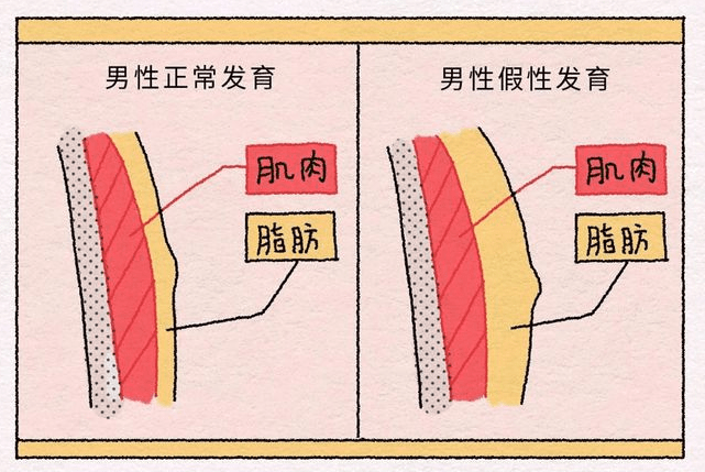 男人乳头正常图片