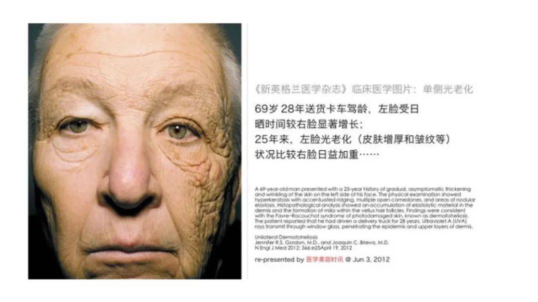 一年买两次,一次用半年:618 护肤购物不完全指南_皮肤_问题_情况