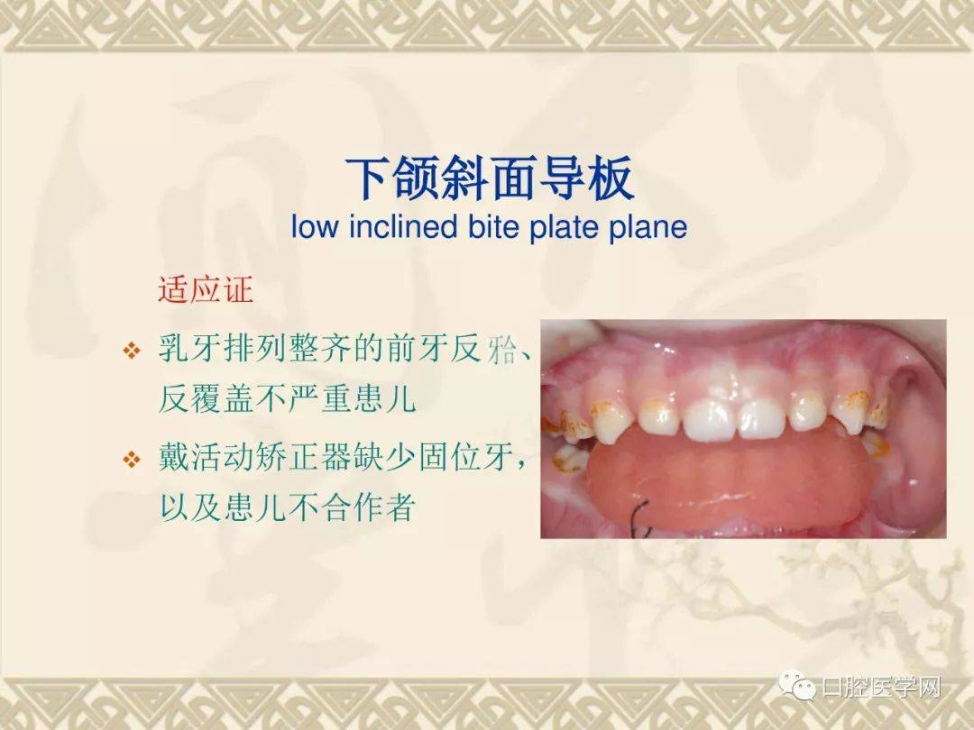 斜导保持器图片