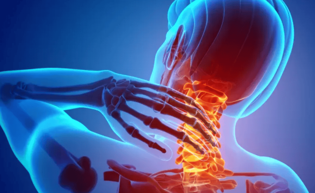 斜角肌造成肩颈疼痛的3大因素