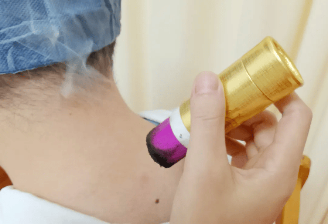 冬病夏治好时机,三伏灸火热预约中