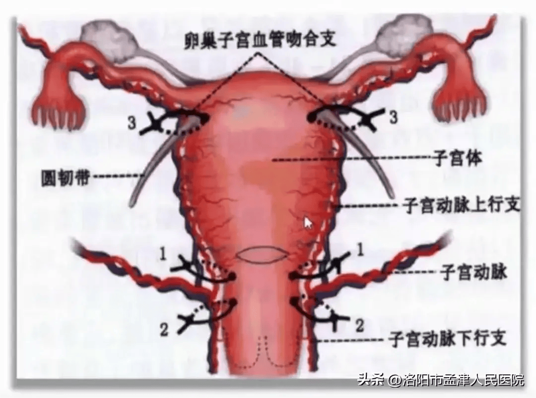 孟津人民医院产科丨突如其来的痛——胎盘早剥