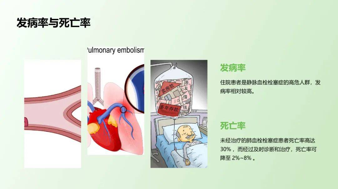 血管栓塞图片