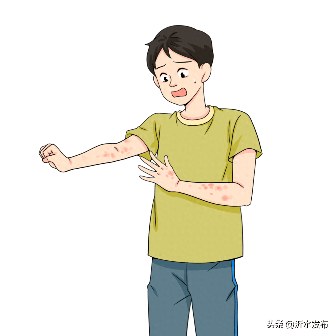 一到夏天手上就长小水泡,皮肤总是又痒又疼?避开这4个误区_皮炎_激素_外用
