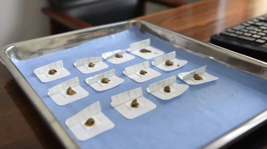 市中医医院贴敷节"火热"启动