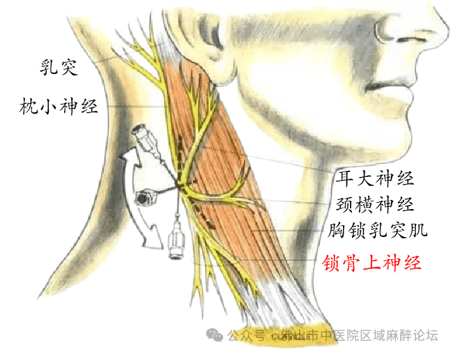 秒“懂”系列——颈浅丛神经损伤?_锁骨_分支_皮肤