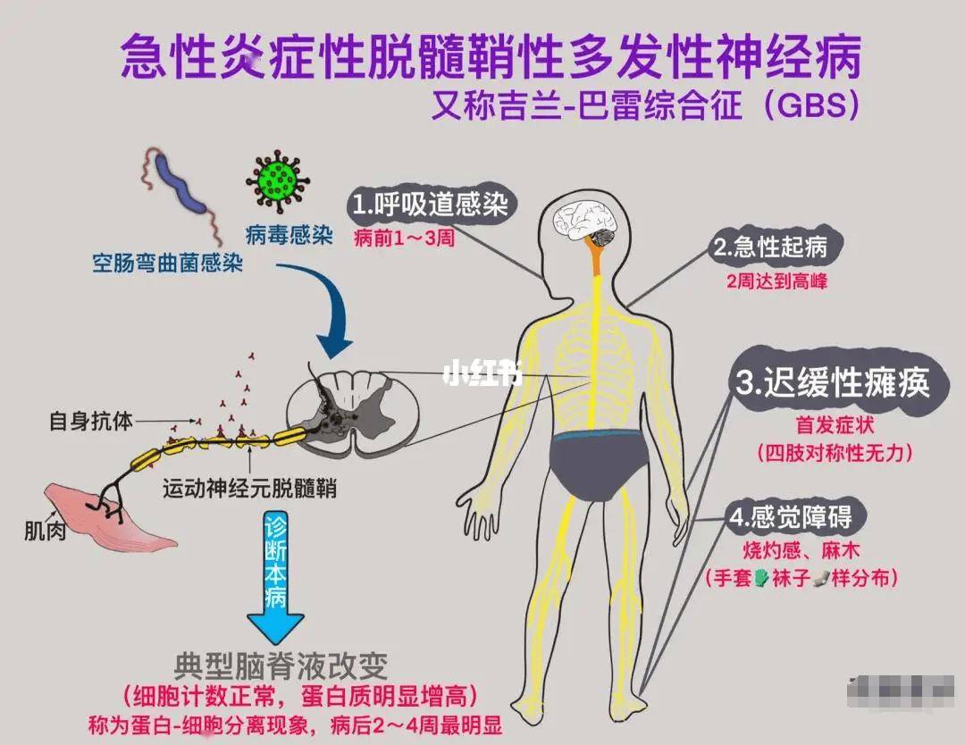 医生提醒 突然手脚发麻