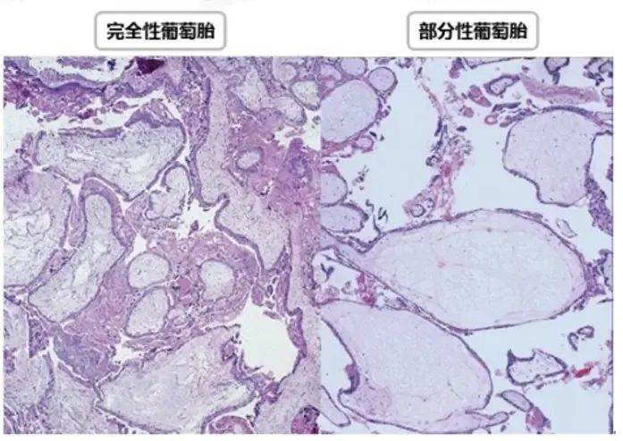 辛苦怀孕