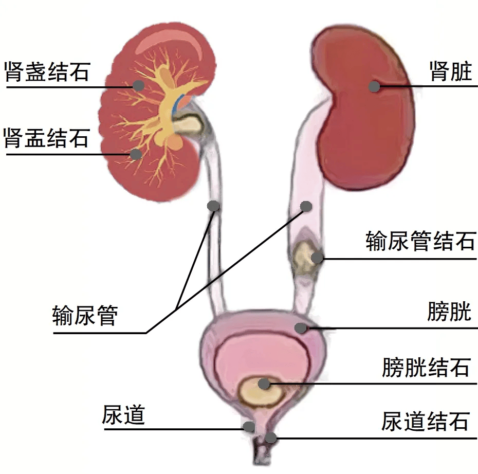 输尿管间襞图片