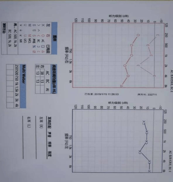 【健康科普】儿童中耳腔里为什么会有"水"?