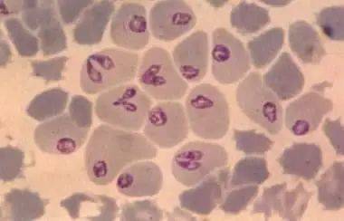 住在血液里面的寄生虫!危险!