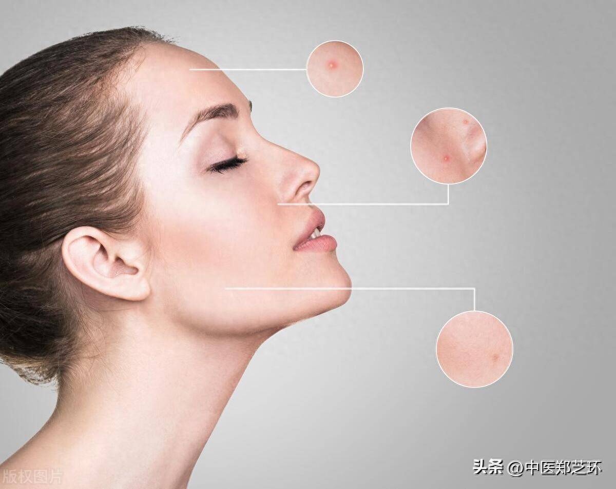 脾虚湿盛让皮肤油腻?中医调理来帮忙!_代谢_脾胃_症状
