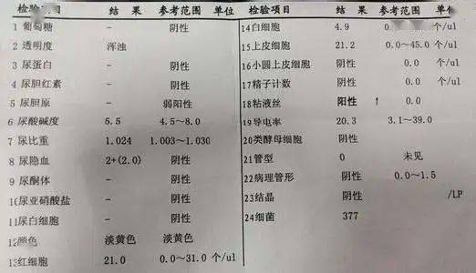 尿沉渣检查图片