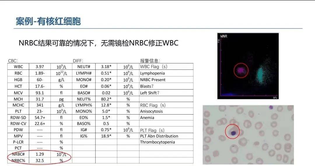 血常规直方图与散点图图片