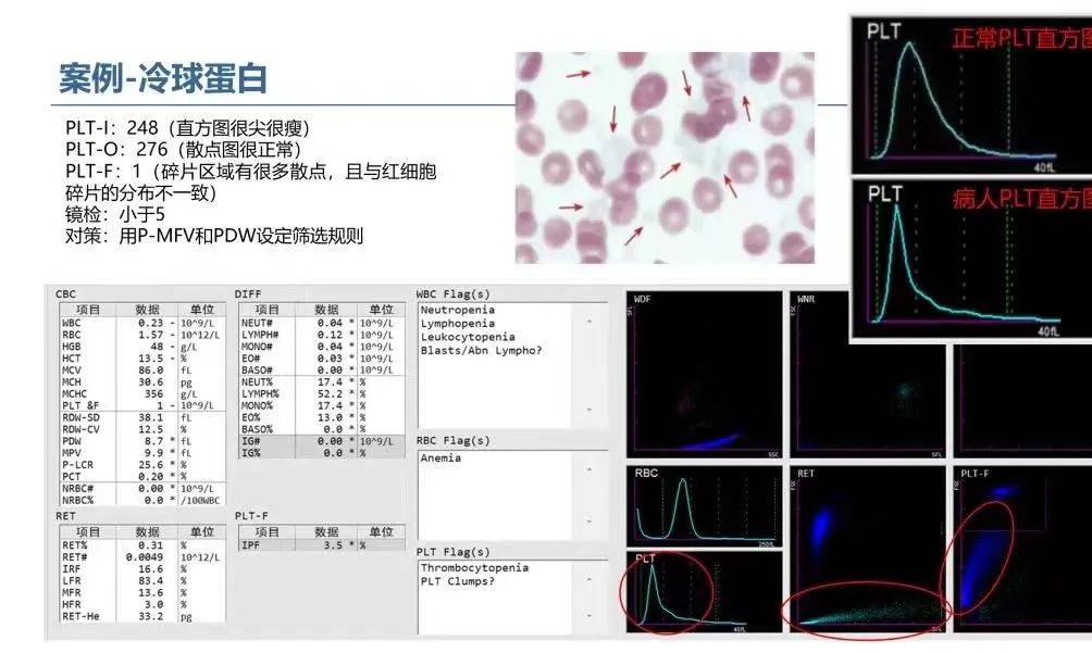 血常规直方图与散点图图片