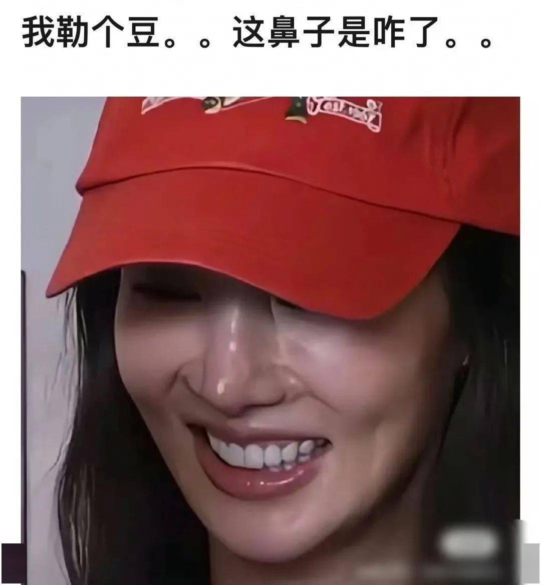 鼻头鼻翼缩小_缩小鼻翼鼻头手术后遗症_缩小鼻翼鼻头手术风险大吗