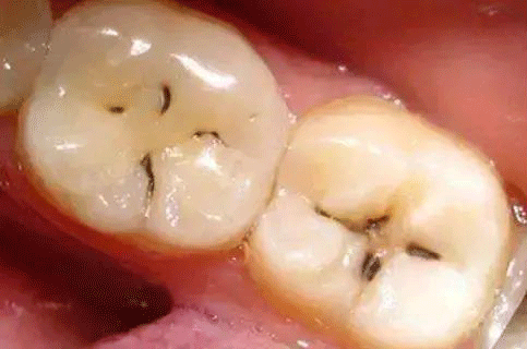 位置靠后,很难清理,食物残渣清理不到位很容易引起肉渣菜叶的发酵腐烂