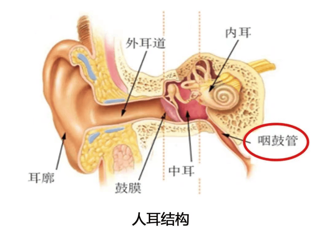 儿童急性中耳炎图片图片