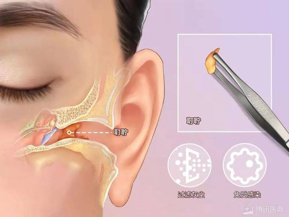 耳道结构耳屎位置图片图片