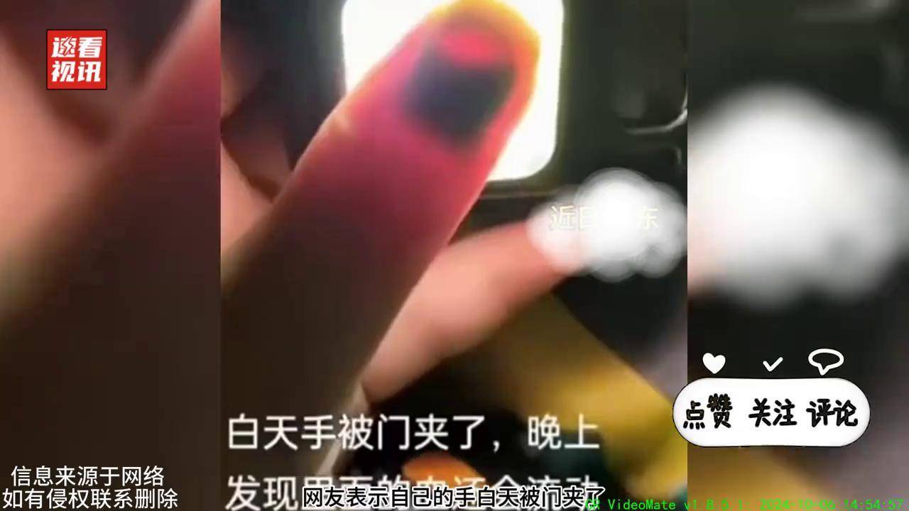 指甲被夹恢复全过程图图片