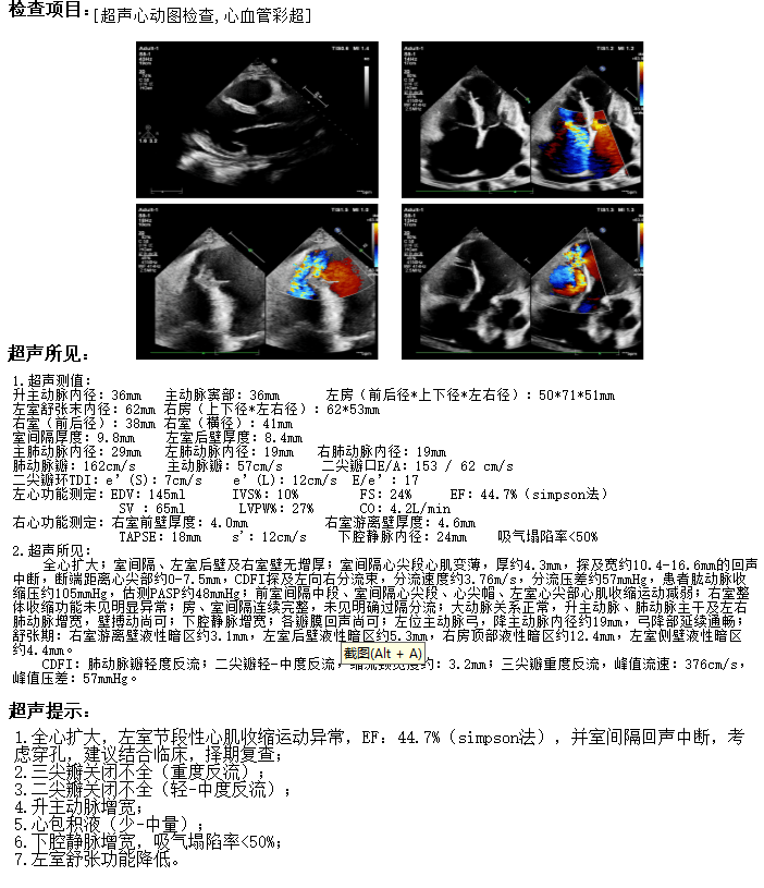 心脏彩超室壁分段图解图片