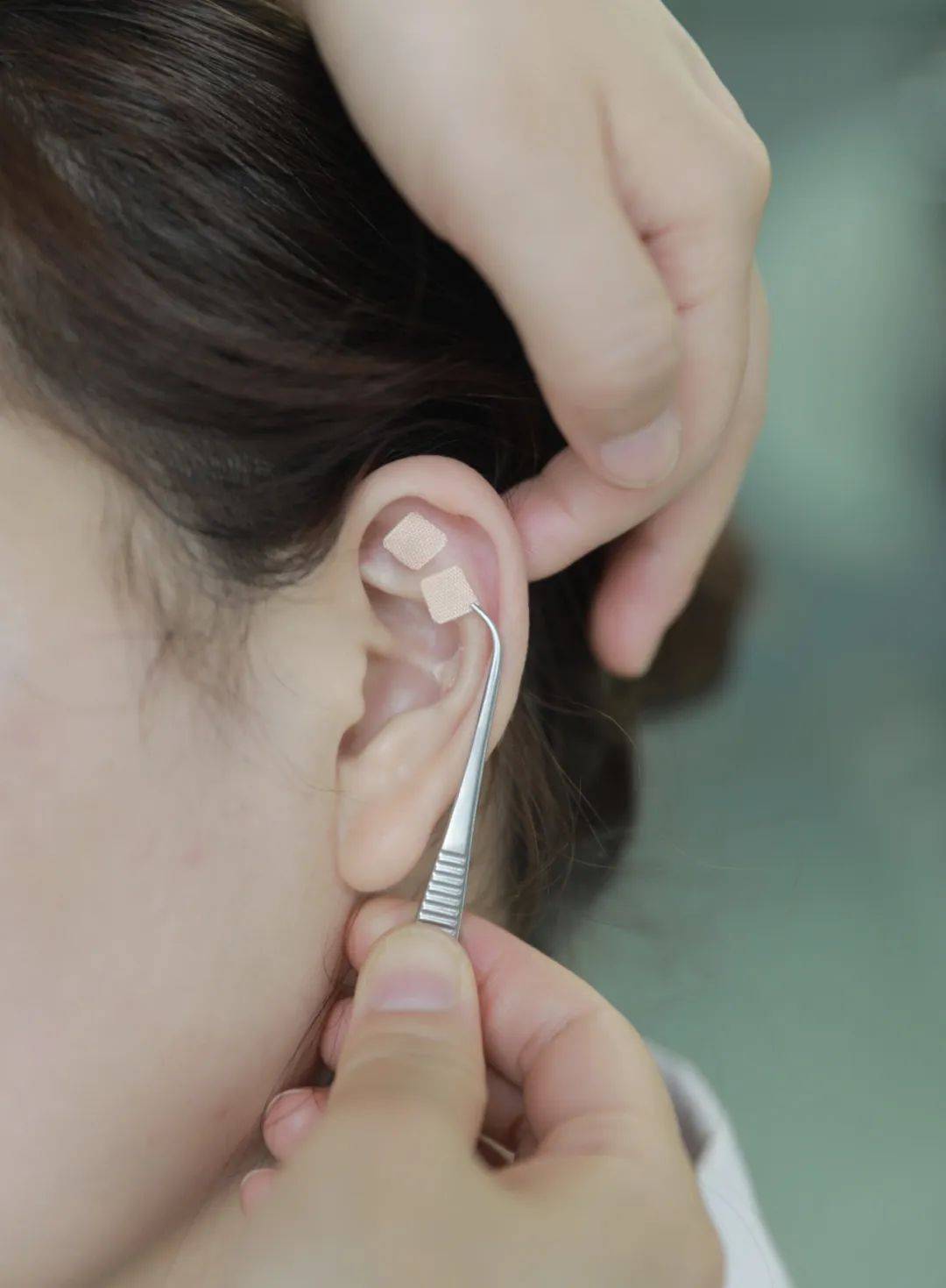 经穴推拿,中药足浴,耳穴埋籽,耳部刮痧,中药督脉熏蒸,平衡罐,健脾安神