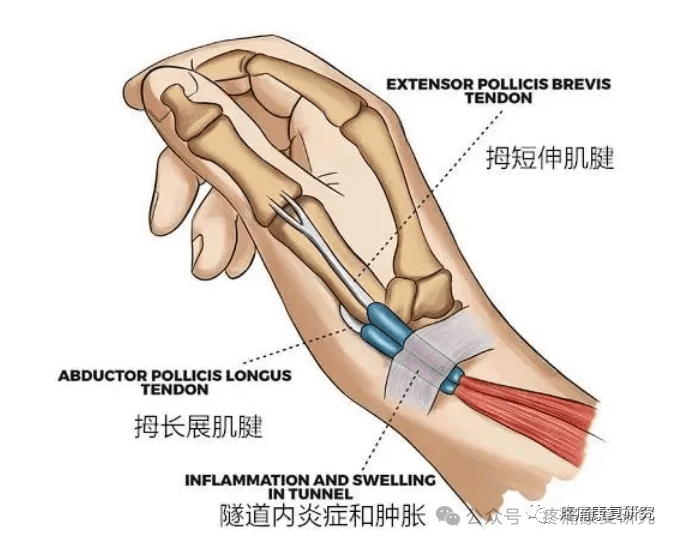 大拇指第二关节在哪里图片