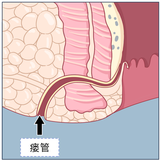 肛门与肠道结构图片图片