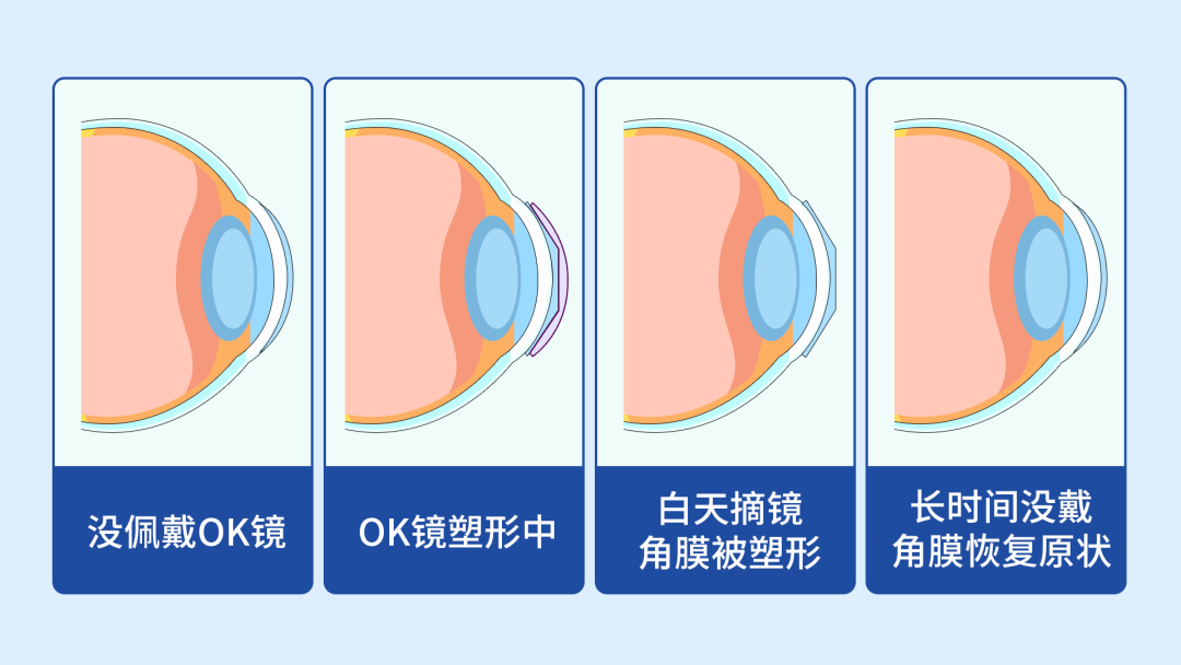 ok镜的危害触目惊心图片