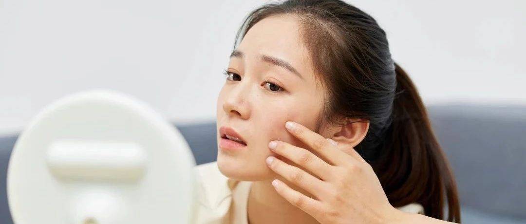 青春期长痘更容易留下痘印!改善青春痘做好10件事_皮肤_痘痘_影响