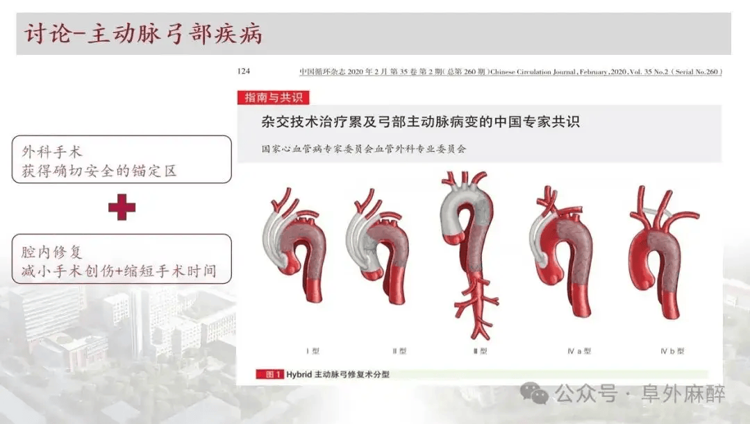 主动脉弓缩窄手术图片