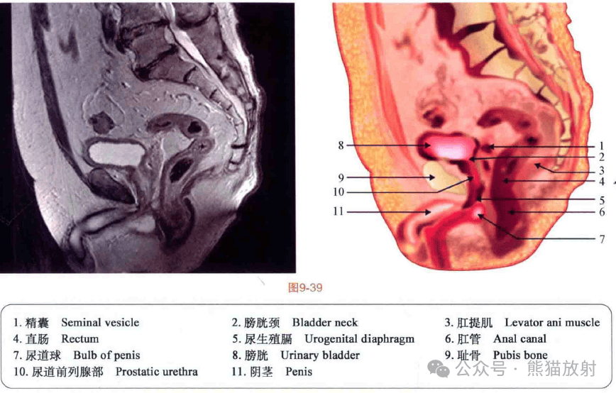 影像解剖丨盆腔