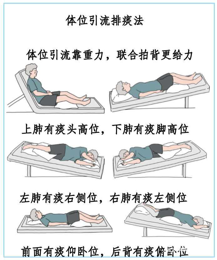 叩背排痰的正确位置图图片