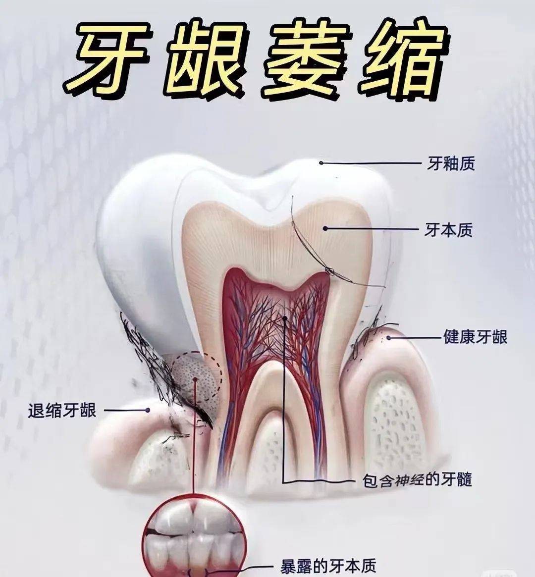 牙床露出白色骨头图片